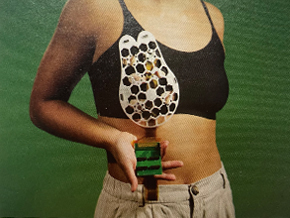 Diagnostic Ultrasound Bra Detects Breast Cancer Earlier