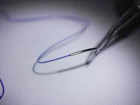 Smart Sutures Could Help Patients Heal After Surgery