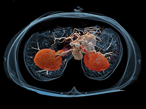 Photon-Counting CT Allows for Comprehensive Lung Imaging