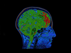 Portable,Ultra-Low-Field MRI System Brings Brain Imaging to Bedside