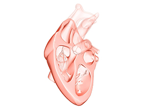 Heart Valve Which Grows Along With Child Could Reduce Invasive Surgeries
