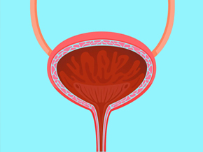 First-In-Human Bladder Transplant to Revolutionize Treatment of Terminally Compromised Bladders