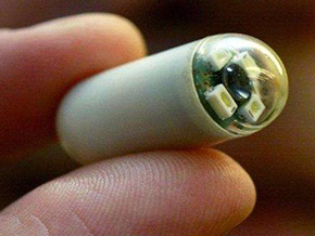 Ingestible Smart Pill Tracks Key Biological Markers of Bowel Diseases in Real Time