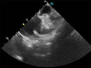 GE HealthCare Acquisition Expands Ultrasound Image Guidance Offerings